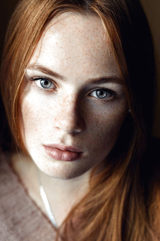 Fair-skinned, Freckled, BEAUTIFUL- V 7