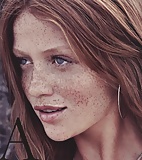 Fair-skinned, Freckled, BEAUTIFUL 20